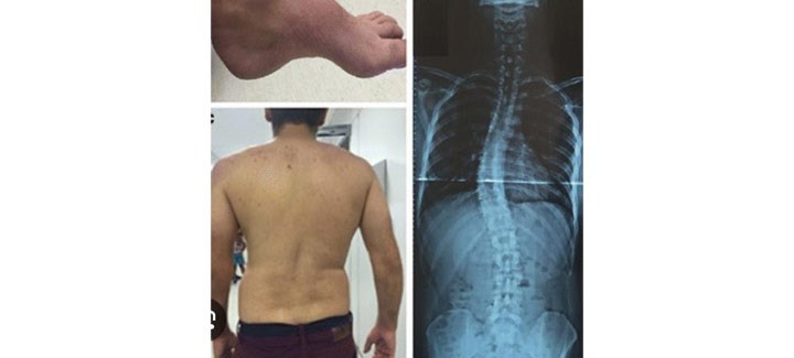 هشتم اسفند به عنوان روز بیماری های نادر نام گذاری شده است